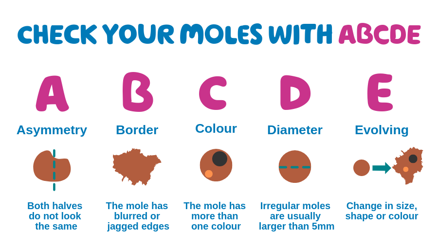 'Check your moles with ABCDE. A Asymmetry Both halves do not look the same. B Border The mole has blurred or jagged edges. C Colour Th emole has more than one colour. D diameter irregular moles are usually larger than 5mm. E Evolving Change in size, shape or colour.