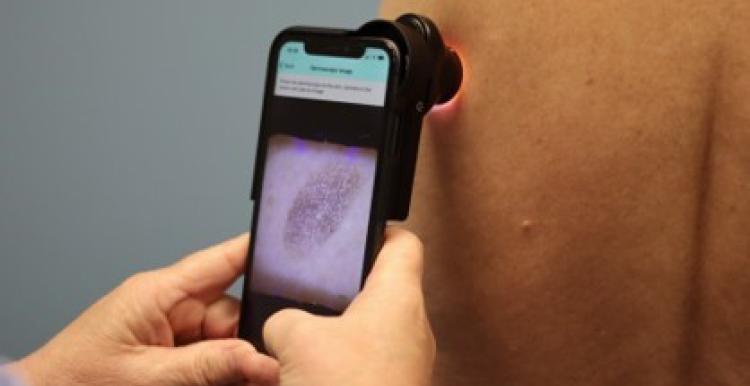 Skin scanner being used on a patients arm.