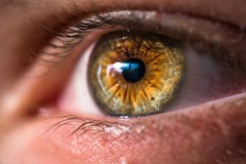 Photograph of an eye. 