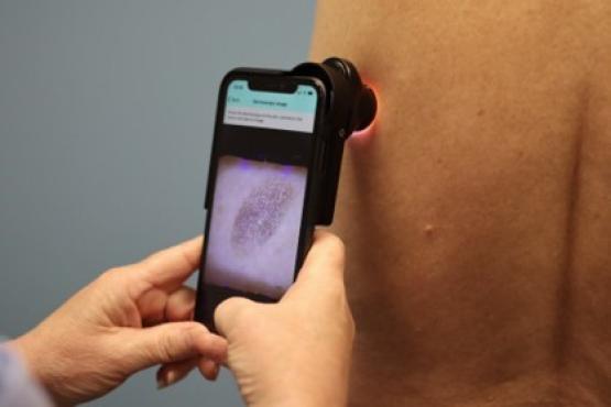 Skin scanner being used on a patients arm.